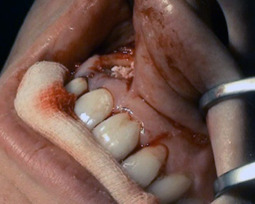 Dentoalveolarna chirurgia Stonek sro – MUDr. Kucera Jan
