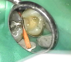 MUDr. Kucera Jan Kosice Stonek - chirurgicka mikroskopia - zubne lekarastvo